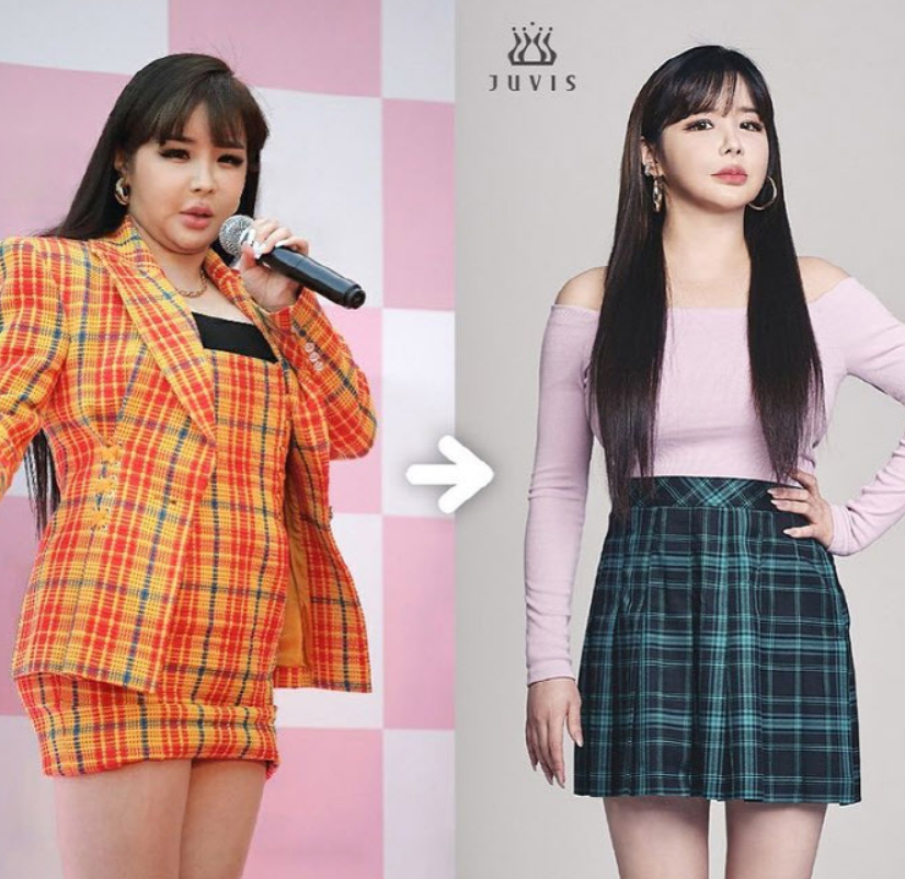 Park Bom, a singer from Group 2NE1, said, “Isn’t diet over?The goal is to be in the early 50kg range.”